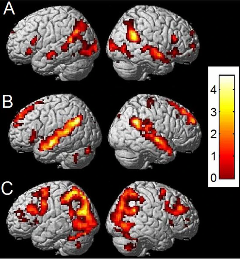 Resonancia magnética funcional (RMf), de participantes mientras juegan al ajedrez. Se observa: a) Actividad cerebral para el desarrollo de empatía del participante durante el juego; b) comprensión del entorno, piezas y acciones; c) procesos visuales, analíticos y de razonamiento. Se plasma, de manera significativa, la intercomunicación entre el hemisferio izquierdo y derecho. Imagen obtenida de Powell et al. 2017